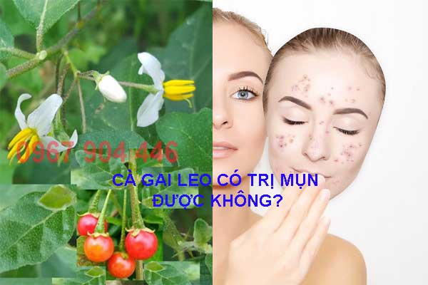 Hướng dẫn dùng cà gai leo trị mụn Hướng dẫn dùng cà gai leo trị mụn